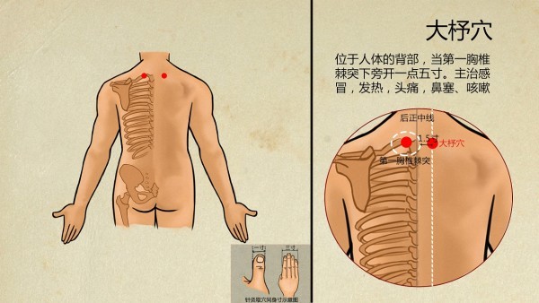 肺栓塞患者的心理调适方法