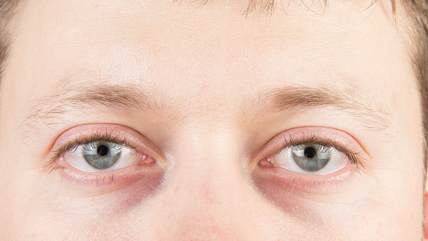 头颈肿瘤早期症状