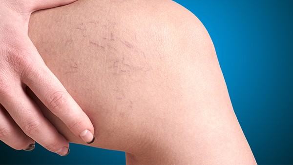 长期咳嗽怎么办