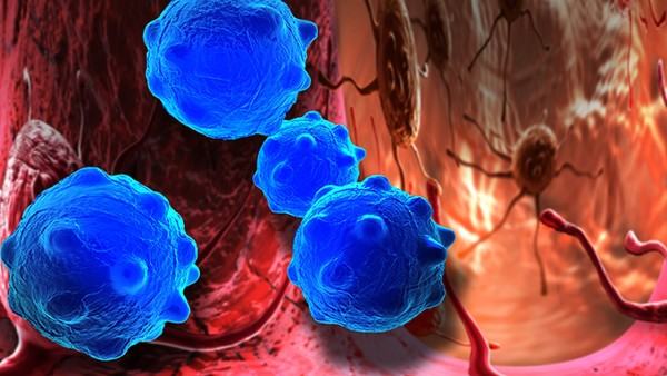 上皮样肉瘤的转移途径