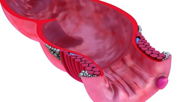 低钠血症饮食中的低钠食物