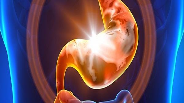 上皮样肉瘤的诊断标准