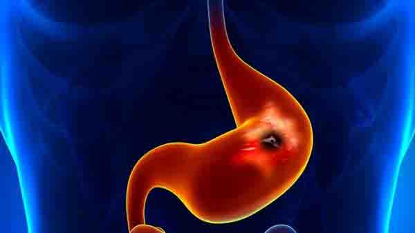 新冠肺炎是否会影响孕妇