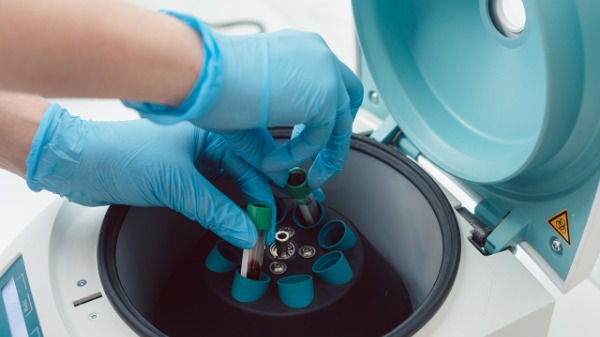 慢性肾病的典型症状