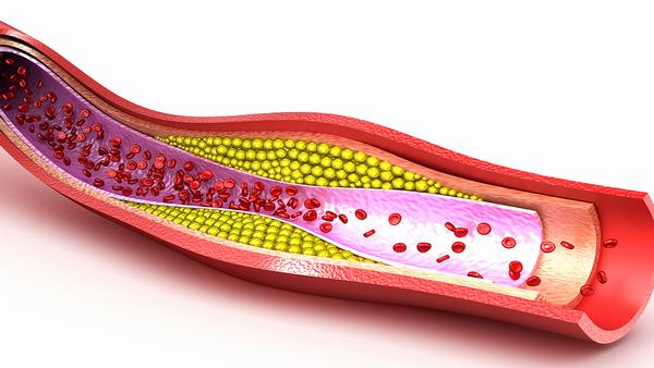 肝功能不全患者的饮食治疗