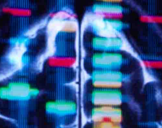 华辉安健立贝韦塔单抗（HH-003）最新临床成果即将亮相AASLD 2025年会